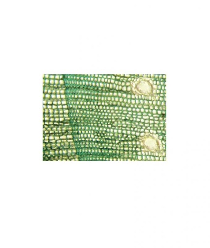 [S60513] Préparation microscopique: Trachéides aréolées CL