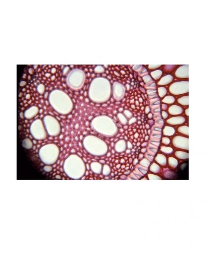 [027049-S60523] Préparation microscopique: Angiospermes - Cellules et tissus: Feuille d'élodée à plat avec chloroplaste