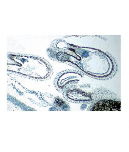 [027119-S60540] Préparation microscopique: Stigmate avec pollen mauve
