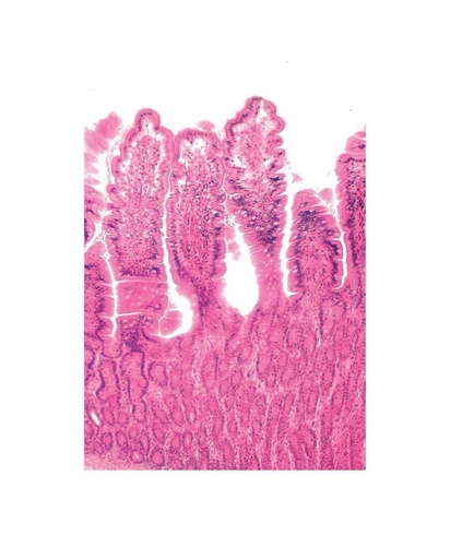 [S67942] Préparation microscopique: Intestin grêle grenouille