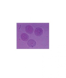 [S66322] Préparation microscopique: Encéphale postérieur jeune souris CT