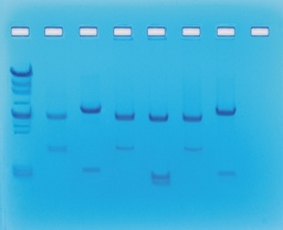 [S68504] Identification génétique à l'aide des enzymes de restriction