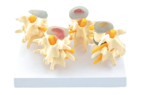 [020109-S68428] Modèle de disque vertébrale grandeur nature