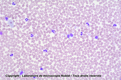 [027387] Pathologie - Sang humain - septicémie - Nublat