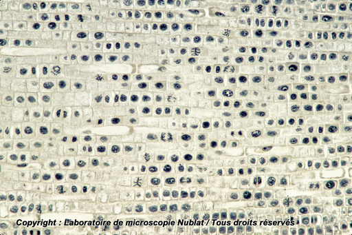 [027753] Mitoses - méristème racinaire terminal - Jacinthe - CL - HF - Nublat