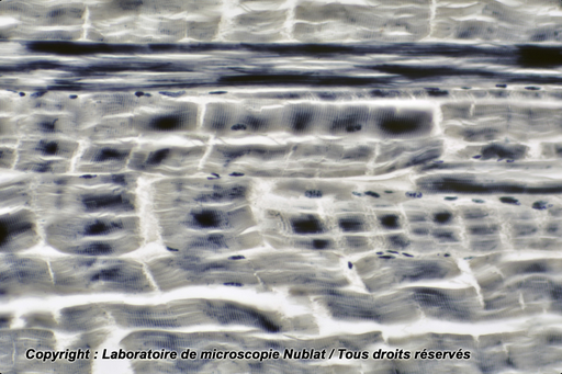 [027533] Muscle strié - CL - pour les stries - HF - Nublat
