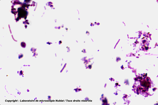 [027552] Bactéries de l’intestin - frottis - GR - Nublat
