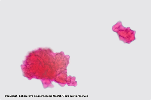 [027586] Agglutination d’hématies A par un sérum d’anticorps anti - A - Nublat