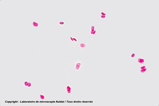 [027587] Absence d’agglutinat -  hématies A+Ac anti - B  - Nublat