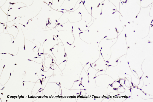 [027598] Spermatozoïdes - Homme - H - Nublat