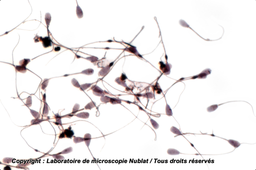 [027599] Spermatozoïdes - Taureau - H - Nublat