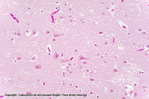 [027621] Cerveau - Homme - HE - Nublat